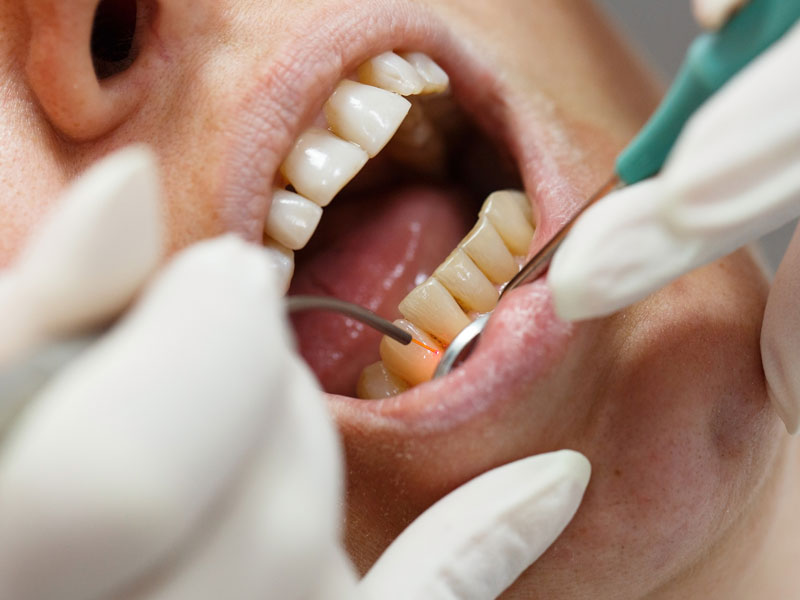 dental patient undergoing laser treatment